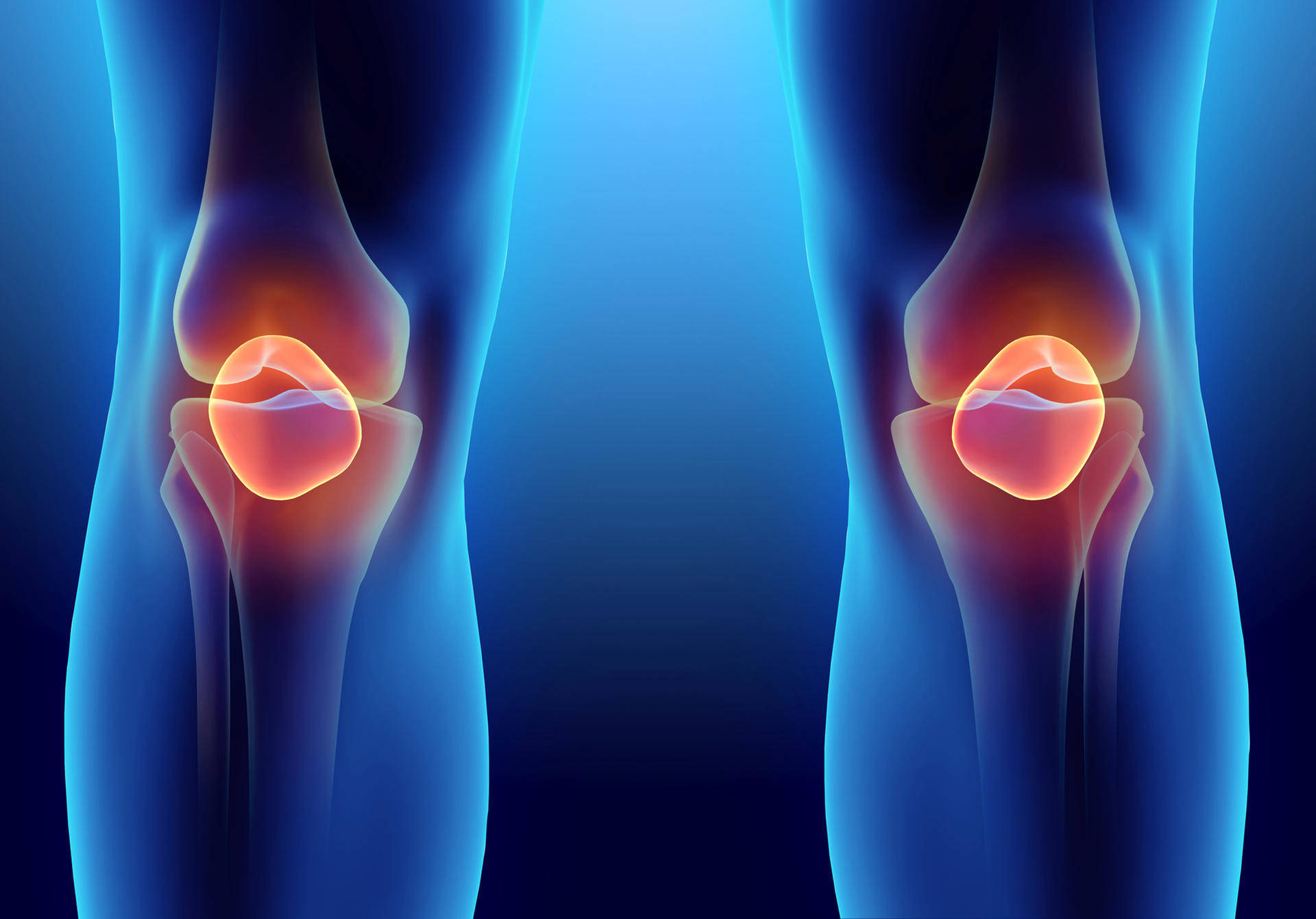 What Causes a Meniscus Tear?