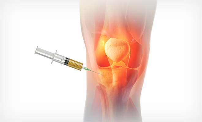 Does PRP Reduce Joint Pain?