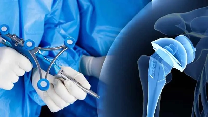 What is Joint Prosthesis Surgery?